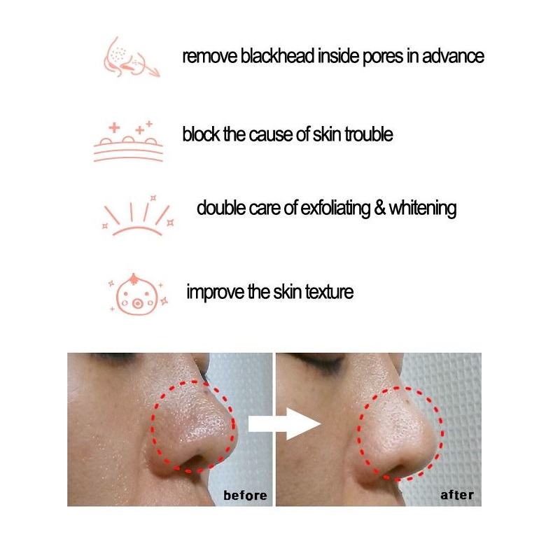 Cosrx BHA Mụn Đầu Đen Điện Liq - đánh giá và giá Skincare Cosrx