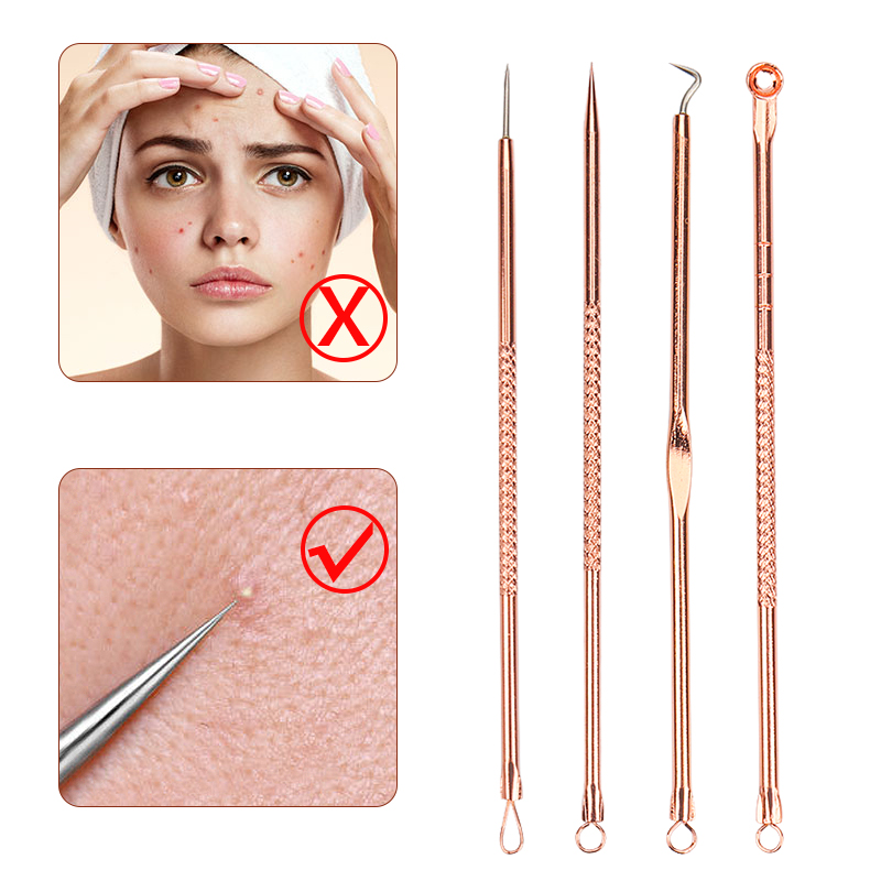 4Pcs/Set Acne Blackhead Needle - đánh giá và giá Skincare Ingredients Checker