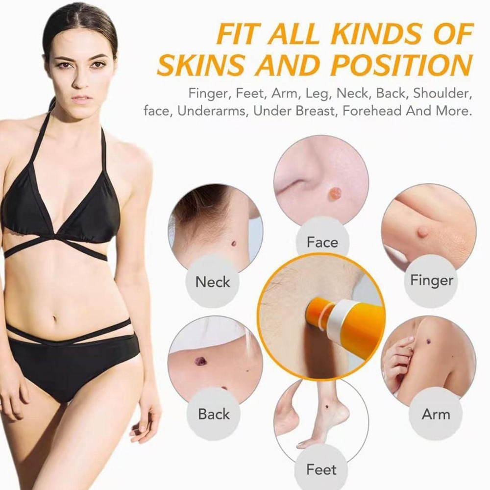 Auto Skin Tag Removal Kit For  - đánh giá và giá Skincare Ingredients Checker