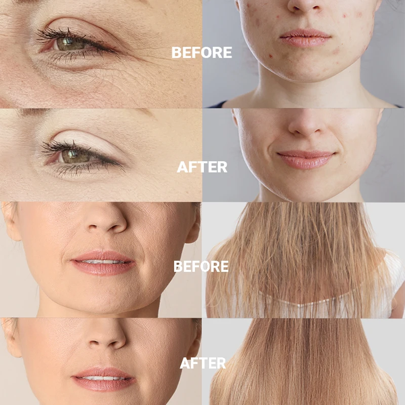 5pcs/set High Frequency Replac - đánh giá và giá Skincare Ingredients Checker
