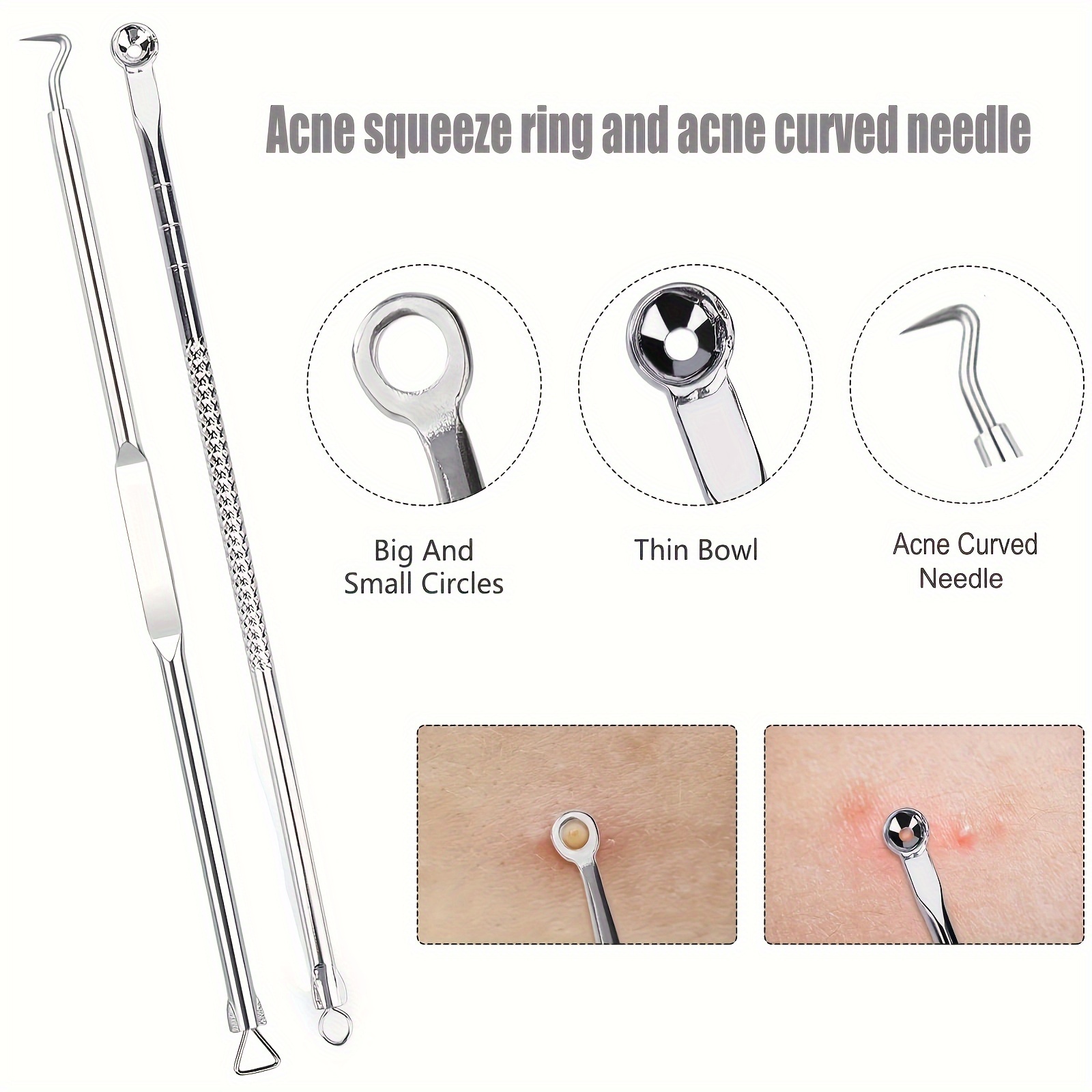 ​6Pcs Stainless Steel Blackhea - đánh giá và giá Skincare Ingredients Checker